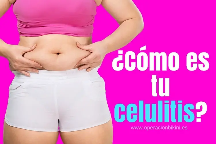 tipos de celulitis