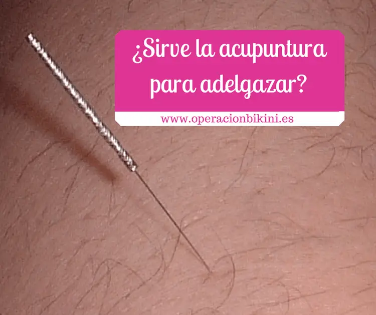 acupuntura adelgazar