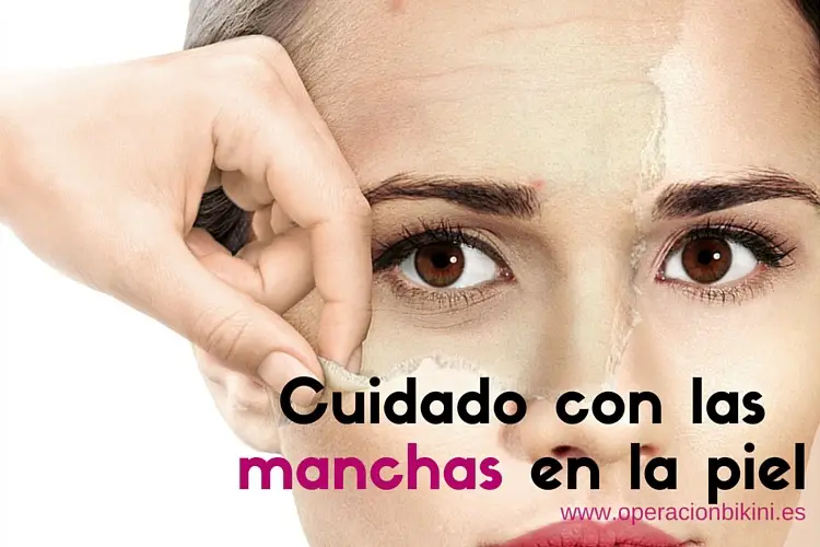 manchas en la piel