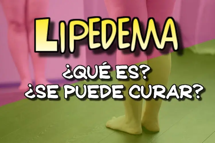 lipedema