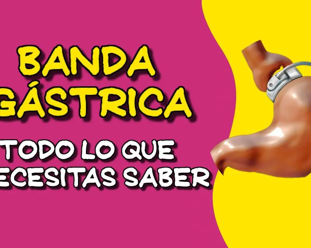 banda gástrica